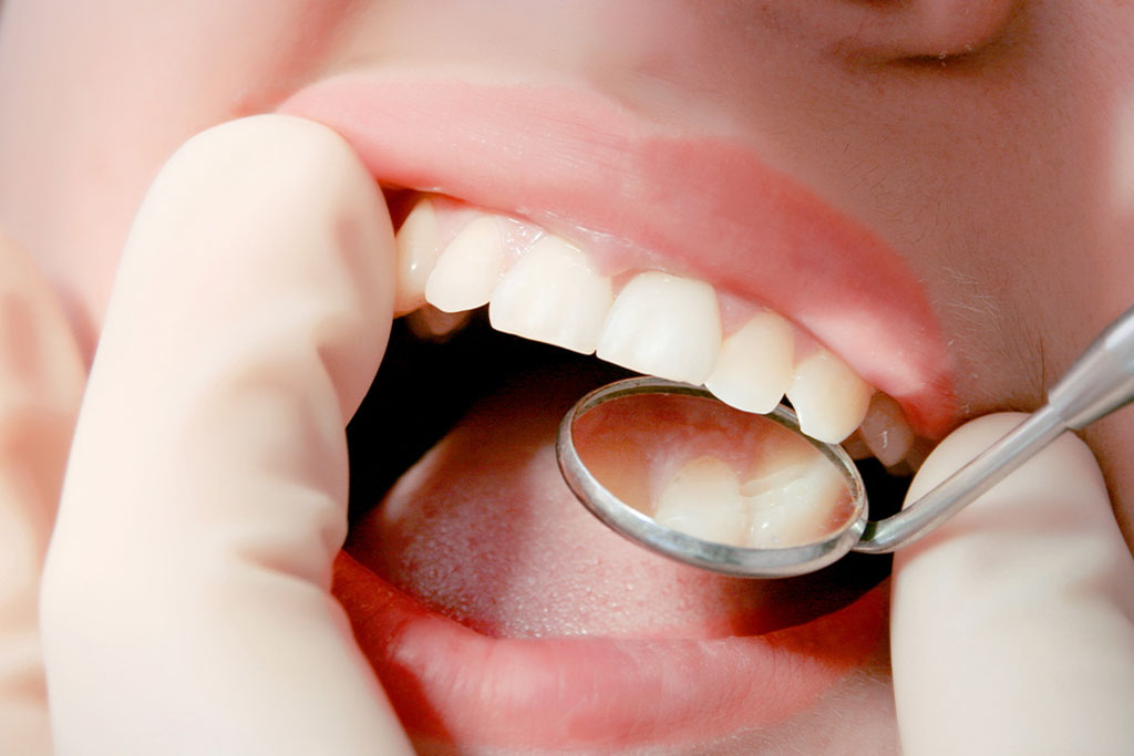 一般歯科診療